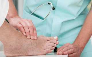 Код мкб 10 инородное тело в передней стенки