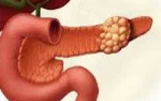 Код по мкб образование поджелудочной железы что это