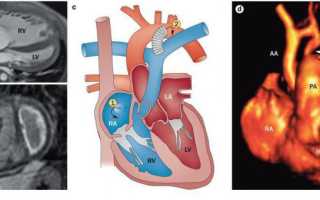 Исследование больных с синдромом артериальной гипертензии