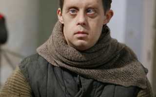 Мечты людей с синдромом дауна