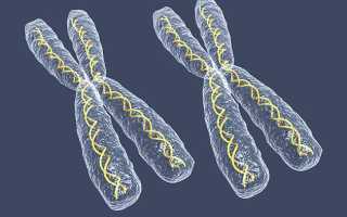 Синдром полисомии по х хромосоме
