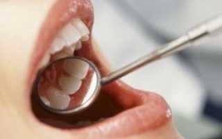 Лечение синдрома мышечно суставной дисфункции