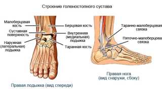Задний импинджмент синдром голеностопного сустава мрт