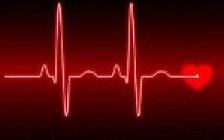 Синусовая аритмия код по мкб 10 у детей