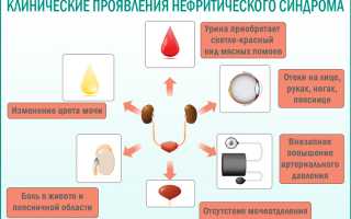 Нефритический синдром и нефротический синдром отличия