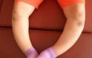 Код по мкб фосфат диабета