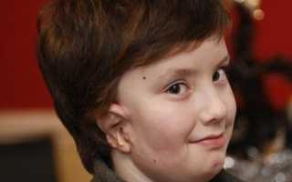 Синдром гольденхара все о нем лечение