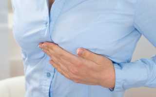 Синдром титце хондрит реберный симптомы