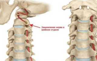 Массаж при шейно черепном синдроме