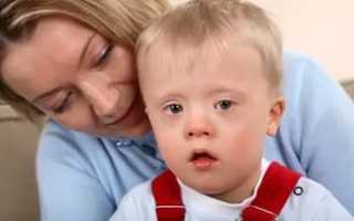 Как берут анализ на синдром дауна