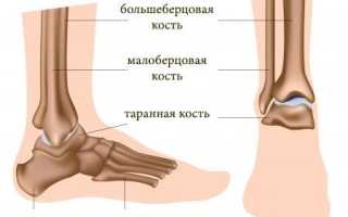 Код мкб растяжение связок правого голеностопного сустава