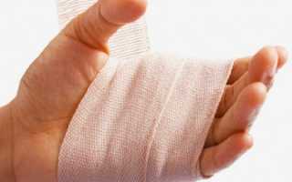 Инфицированная рана пальца код мкб