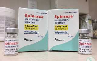 Синдром правой сма что это