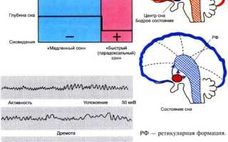 Код по мкб бессонница