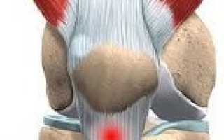 Тендинит сухожилия стопы код по мкб 10