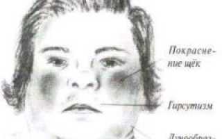 Синдром кушинга при раке легкого