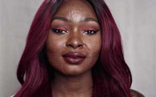 Множественные раны лица код по мкб 10