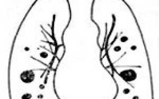 Мтс печени код мкб