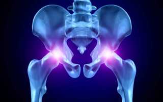 Артрозо артрит тазобедренного сустава код мкб 10