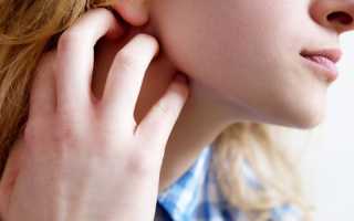 Код мкб абсцесс подчелюстной области