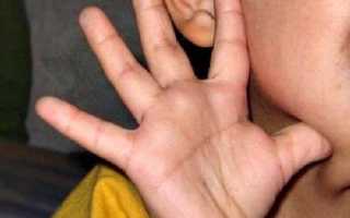 Развивающие занятия ребенка с синдромом дауна в 2 года