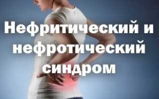 Нефритический и нефротический синдром отличия