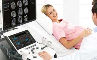 Двс синдром при отслойке плаценты