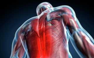 Миофасциальный синдром в грудном отделе позвоночника