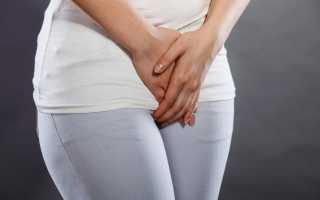 Паховый лимфаденит у женщин код по мкб 10