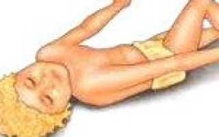 Судорожный синдром неясной этиологии по мкб 10