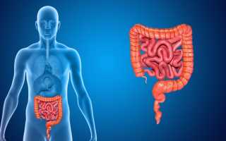 Расстройство кишечника код мкб