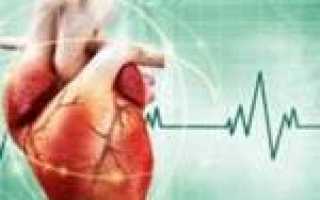 Нижнепредсердный ритм код по мкб 10