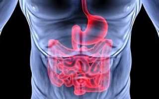 Кишечное кровотечение мкб код