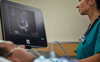 Синдром укороченного интервала pq по мкб 10