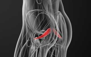 Как долго лечится синдром грушевидной мышцы