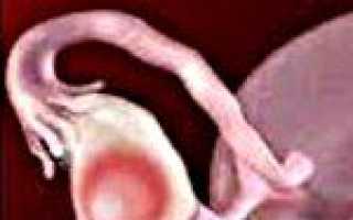 Код диагноза по мкб д27 что это