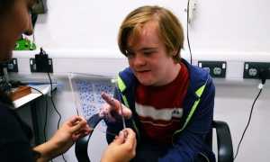 Что такое дети с синдромом дауна причины