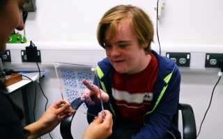 Что такое дети с синдромом дауна причины