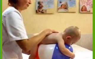 Синдром мышечной гипотонии в год