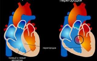 Ооо дмжп код по мкб