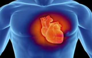 Чем синдром отличается от заболевания