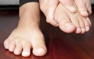 Синдром диабетической стопы мкб 10 код