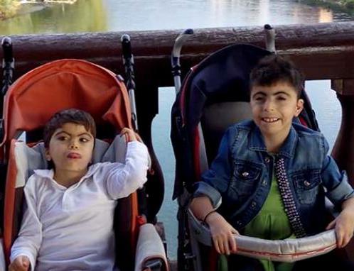 синдром Корнелии де Ланге