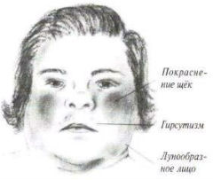 Синдром кушинга при раке легкого