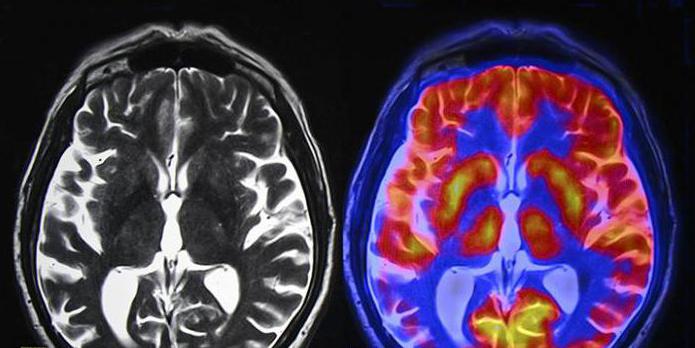 резидуально органическое поражение цнс код мкб 10