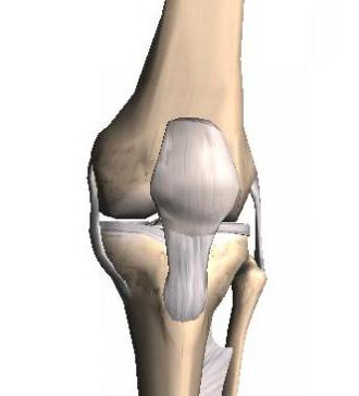 артроз коленного сустава
