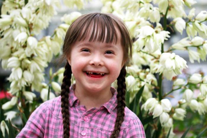 рождение ребенка с синдромом дауна