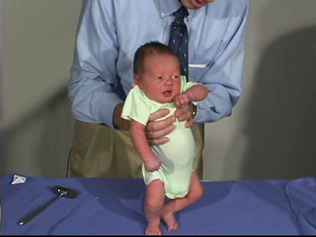 исключение дистонии