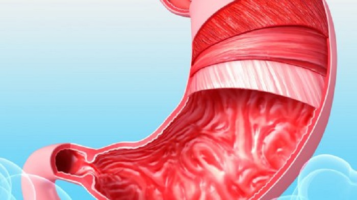 Причины возникновения язв в желудке