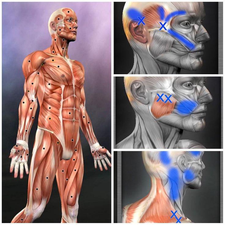 Основные триггерные точки